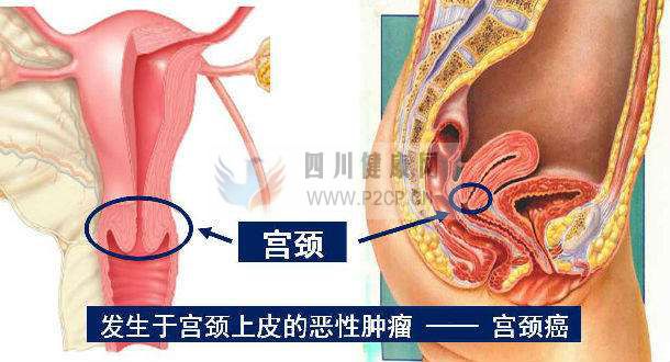 晚婚晚育竟然是不孕不育症的根本原因