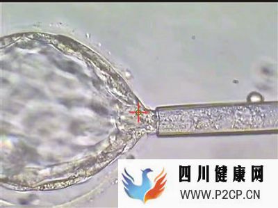 四川:27对夫妇已接受第三代试管婴儿(图2) 四川:27对夫妇已接受第三代试管婴儿(图2)
