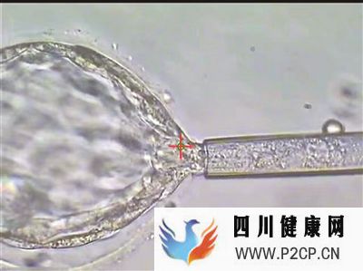 四川：27对夫妇已接受第三代试管婴儿(图2)