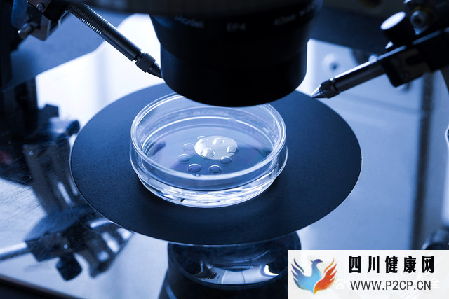 哪些情况可以做第三代试管技术?(图3) 哪些情况可以做第三代试管技术?(图3)