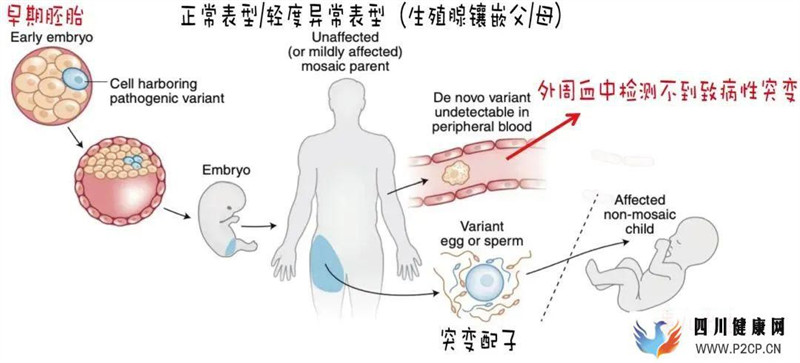 四川：四次不良妊娠史，多年艰难求子路，国际首例性腺基因嵌合行三代试管技术助孕婴儿健康诞生(图3)