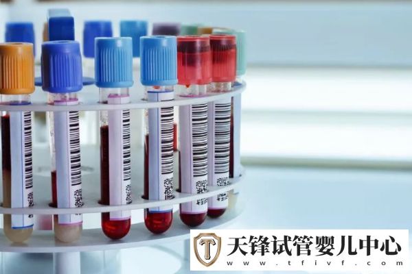 HCG能判断是否怀孕