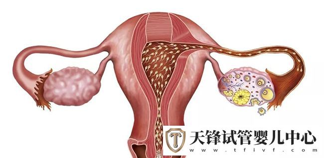 试管婴儿高频问题之输卵管，5个维度的通畅度分析(图1)