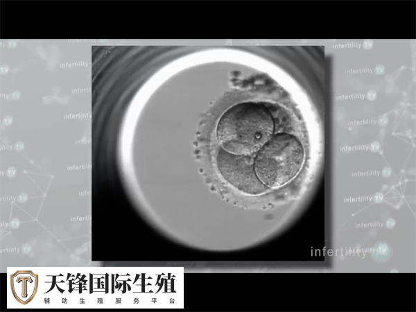 0d143079730ee3ee8b066b56e0ca7831_1741997163722429.png