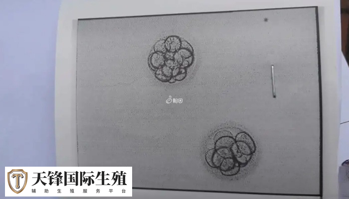 移植冻胚和鲜胚哪个先测出来