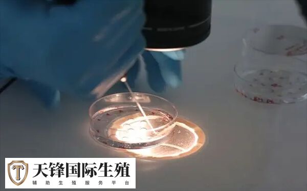 染色体异常情况一般会建议做三代试管婴儿