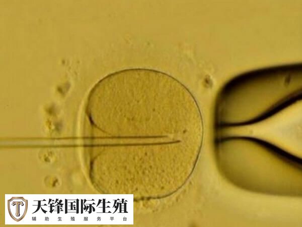 试管费用则取决于试管技术的选择