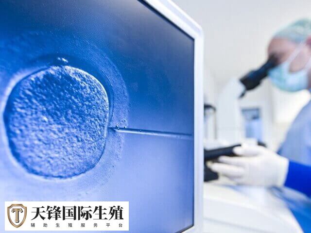 影响试管婴儿费用的因素包括试管技术