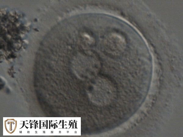 一代转二代是基于现有卵子的补救措施