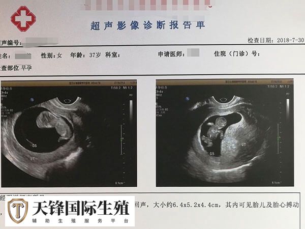 les可到美国做试管生子